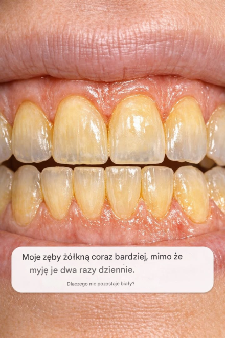 Moje zęby robią się coraz bardziej żółte, mimo że myję je dwa razy dziennie. Dlaczego nie chcą pozostać białe?