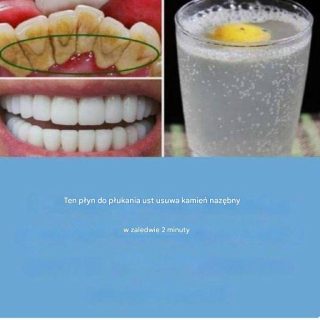 Jak mieć białe zęby: 11 wskazówek, jak mieć piękny uśmiech!