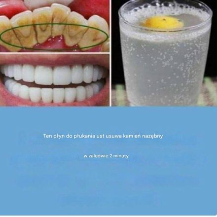 Jak mieć białe zęby: 11 wskazówek, jak mieć piękny uśmiech!