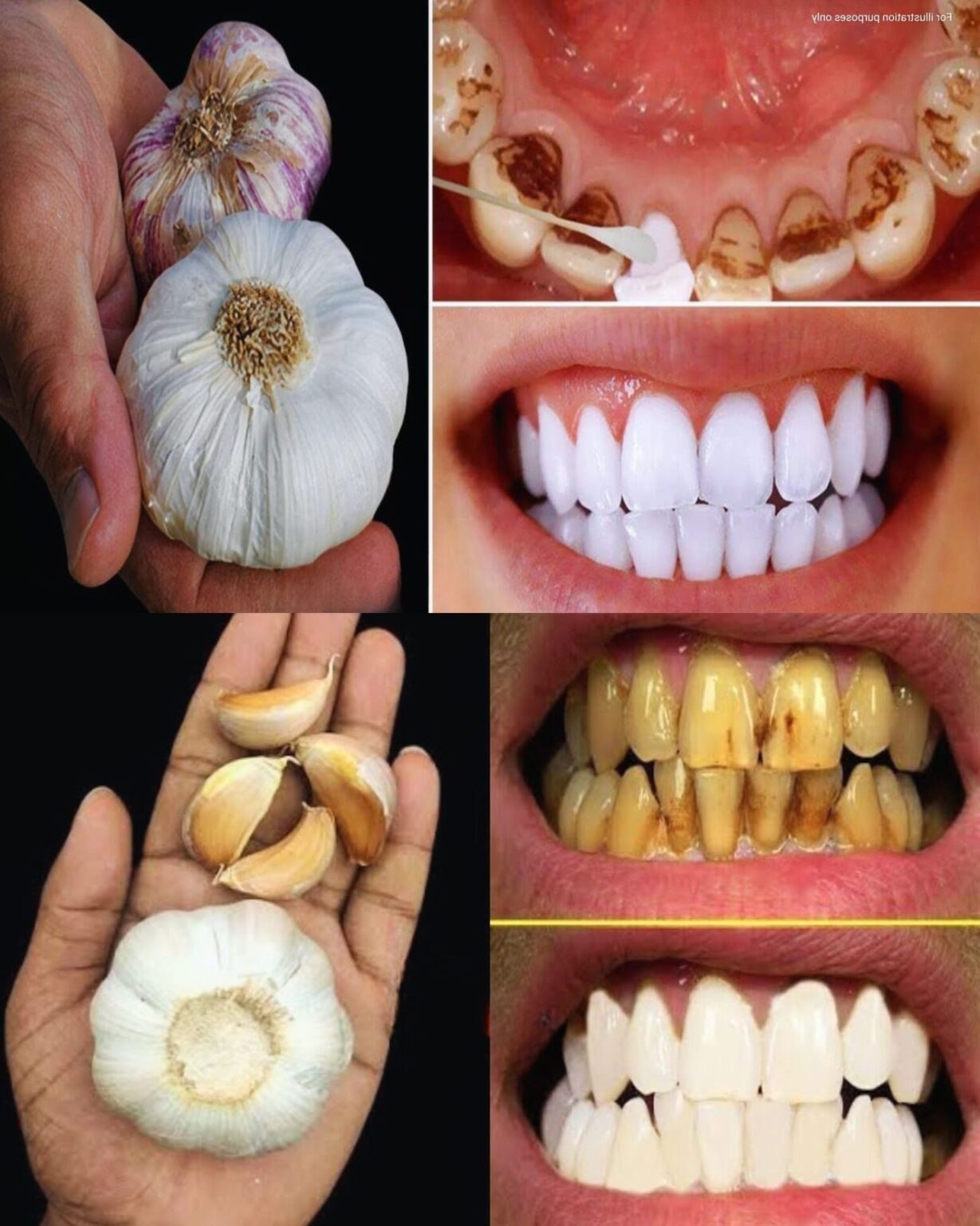 Tajemnica, której dentyści nie chcą ujawnić: jak szybko usunąć kamień nazębny i wybielić zęby w domu!