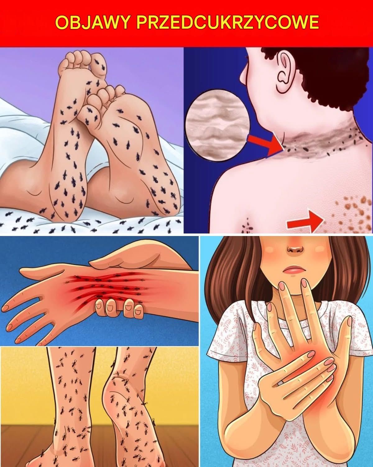 Nie ignoruj ​​tego: 12 ostrzegawczych objawów stanu przedcukrzycowego i co może pomóc